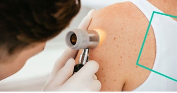 Dermatologia: calendarizzazione e strumenti digitali per la prevenzione